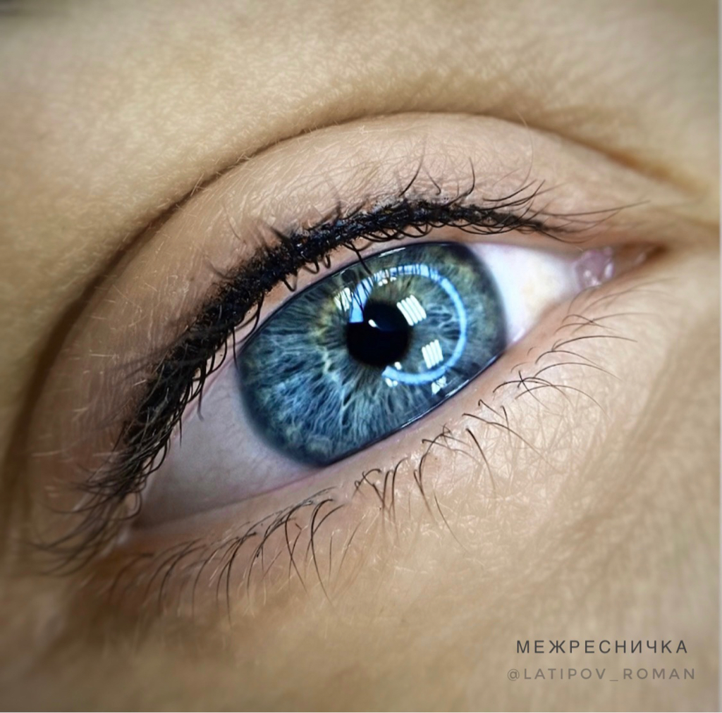 Межресничка