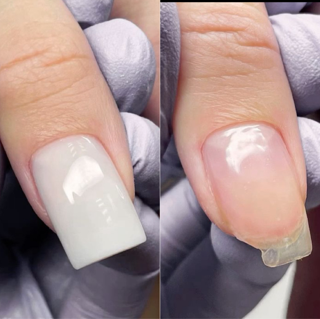 Ремонт одного ногтя