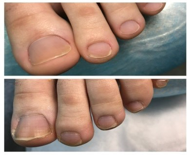 Полный педикюр без покрытия