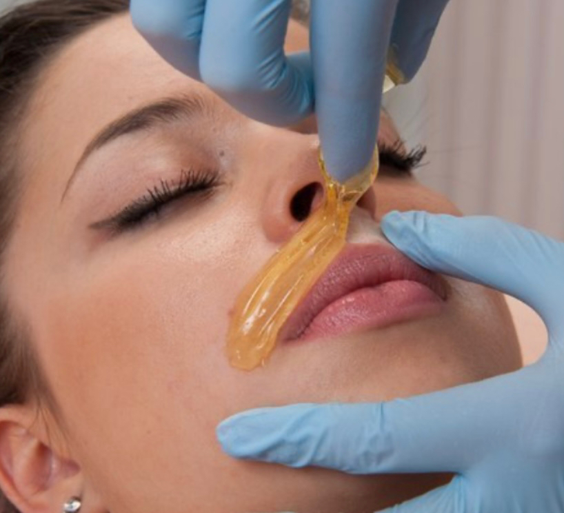 Депиляция усики