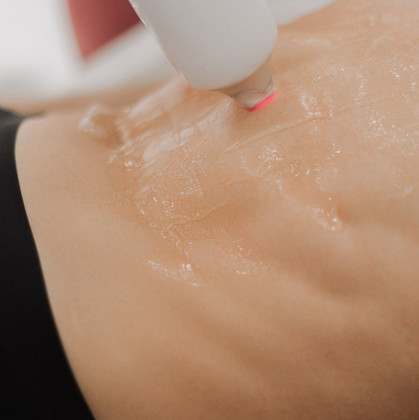 Мужская лазерная эпиляция торса