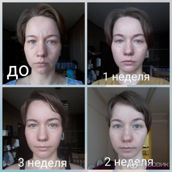 Массаж лица авторский + маска по типу кожи (абонемент 5 процедур)