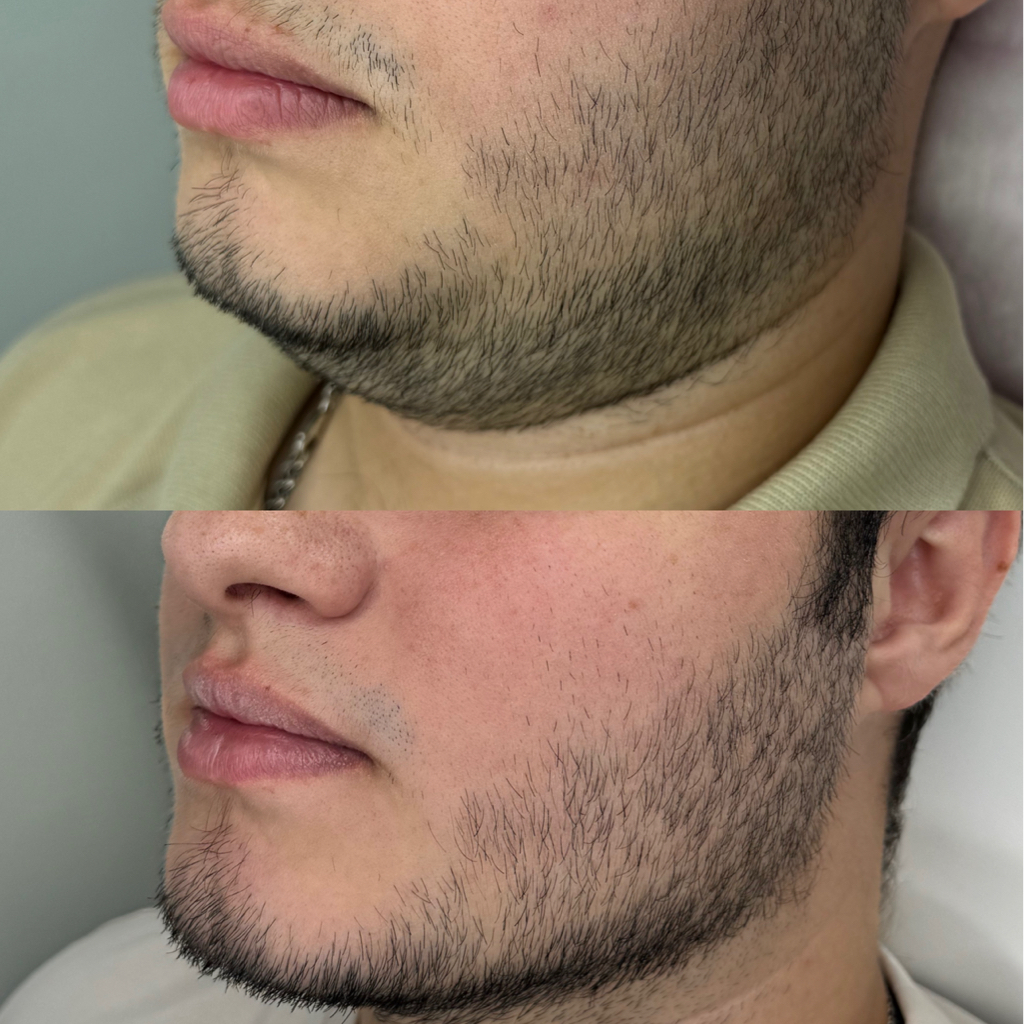 Липолитик БИОГЕЛЬ СТРОЙНОСТЬ