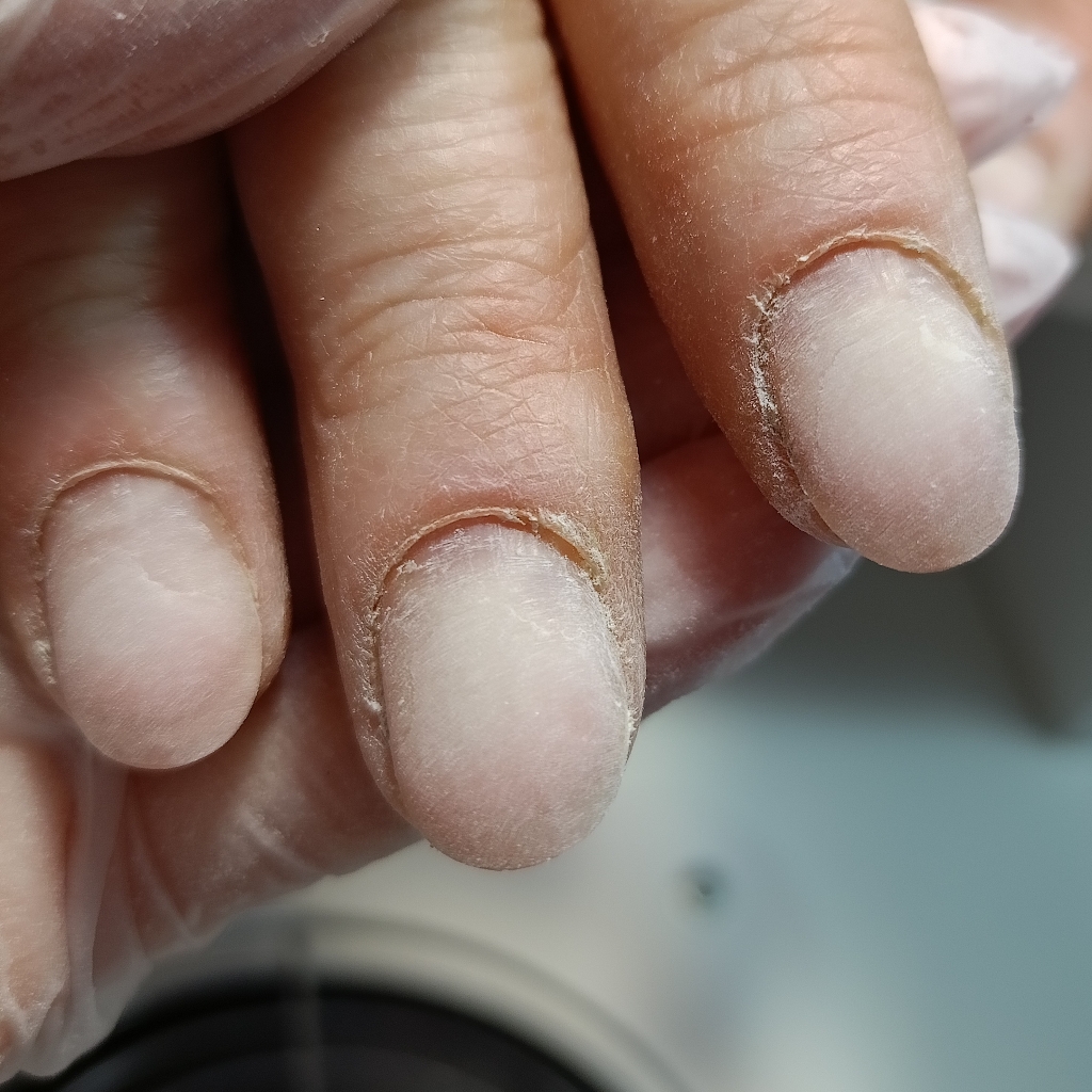 Снятие без последующего покрытия