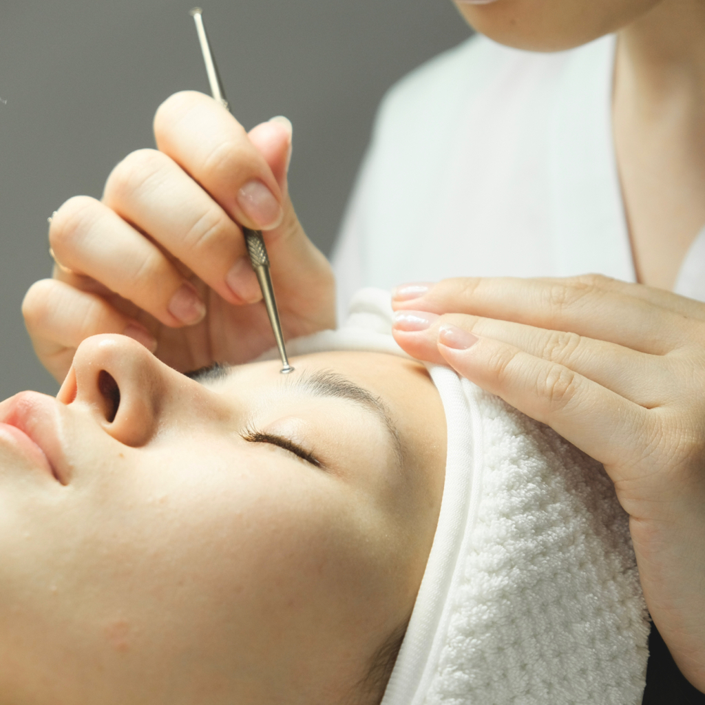 Консультация по лечению акне