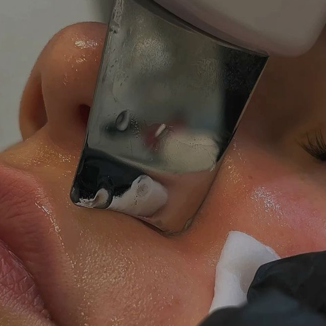 Чистка лица Total с пилингом и Led маской.