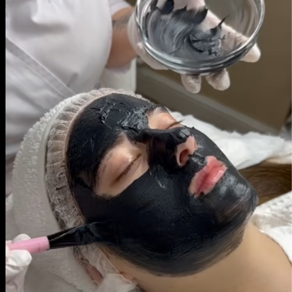 Карбоновый пилинг