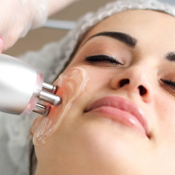 RF лифтинг лица