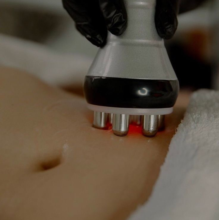 RF лифтинг+ вакуумный массаж (животик + бока) 1 сеанс