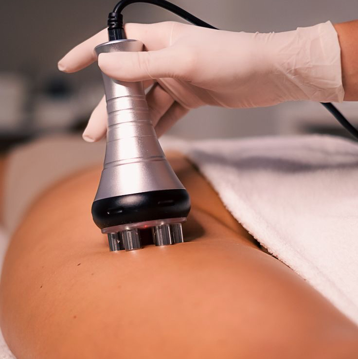 RF лифтинг+вакуумный массаж (бёдра 1ст + ягодицы + живот + бока) 1 сеанс