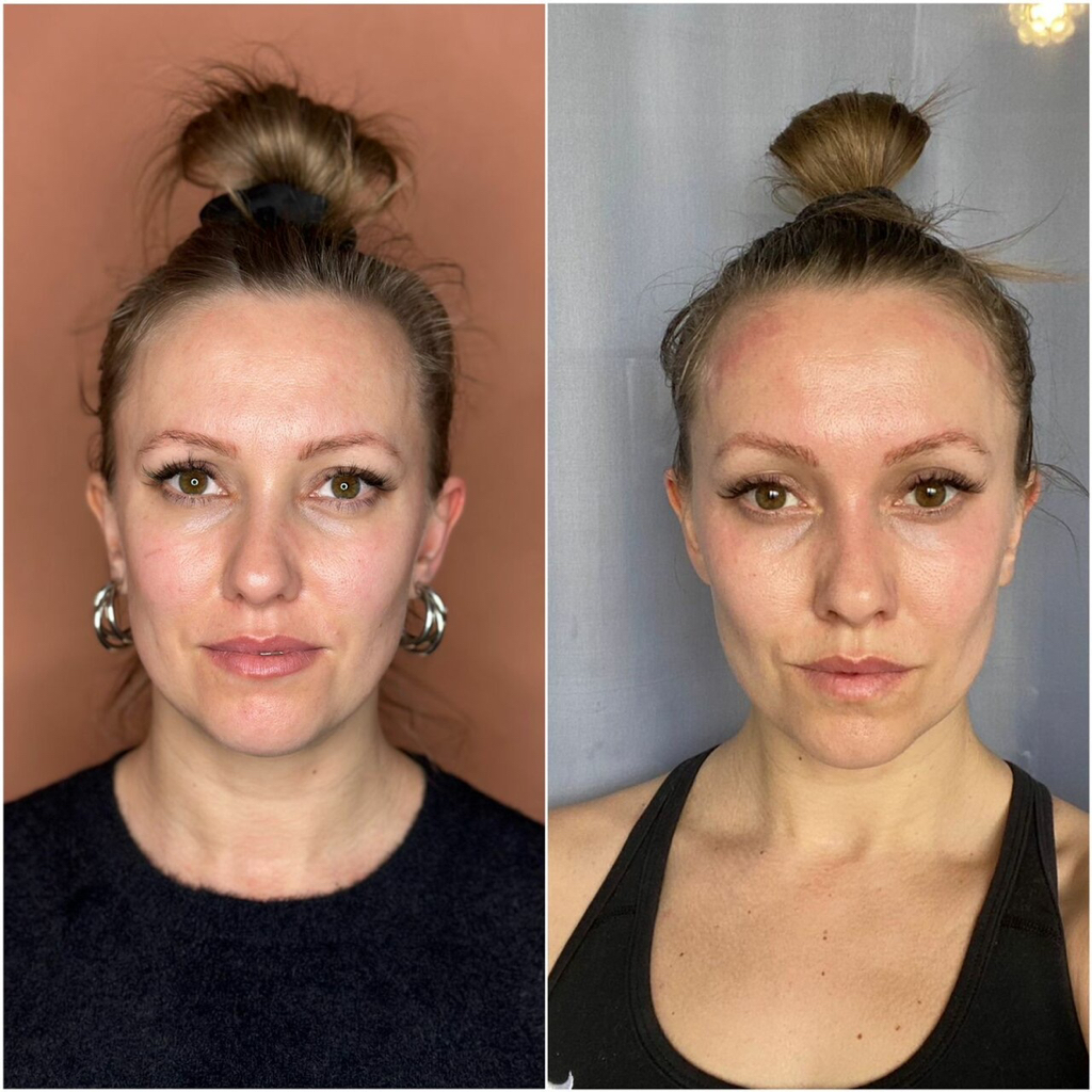 Программа «Молодость и свежесть лица» 10 сеансов (цена за 1 сеанс)