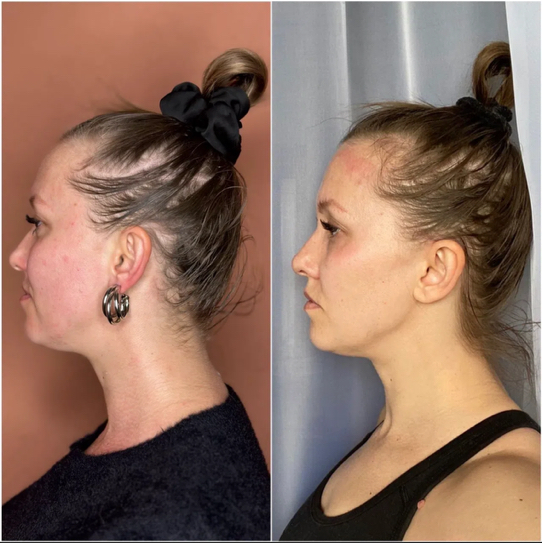 Программа «Молодость и свежесть лица» - 5 сеансов (цена за 1 сеанс)