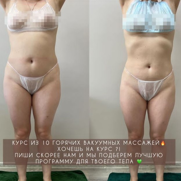 Акция первое посещение горячий вакуумный массаж
