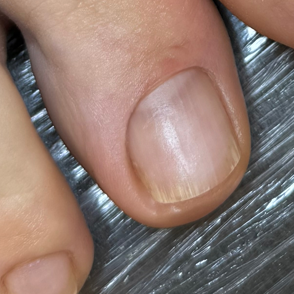 Гигиенический педикюр без покрытия