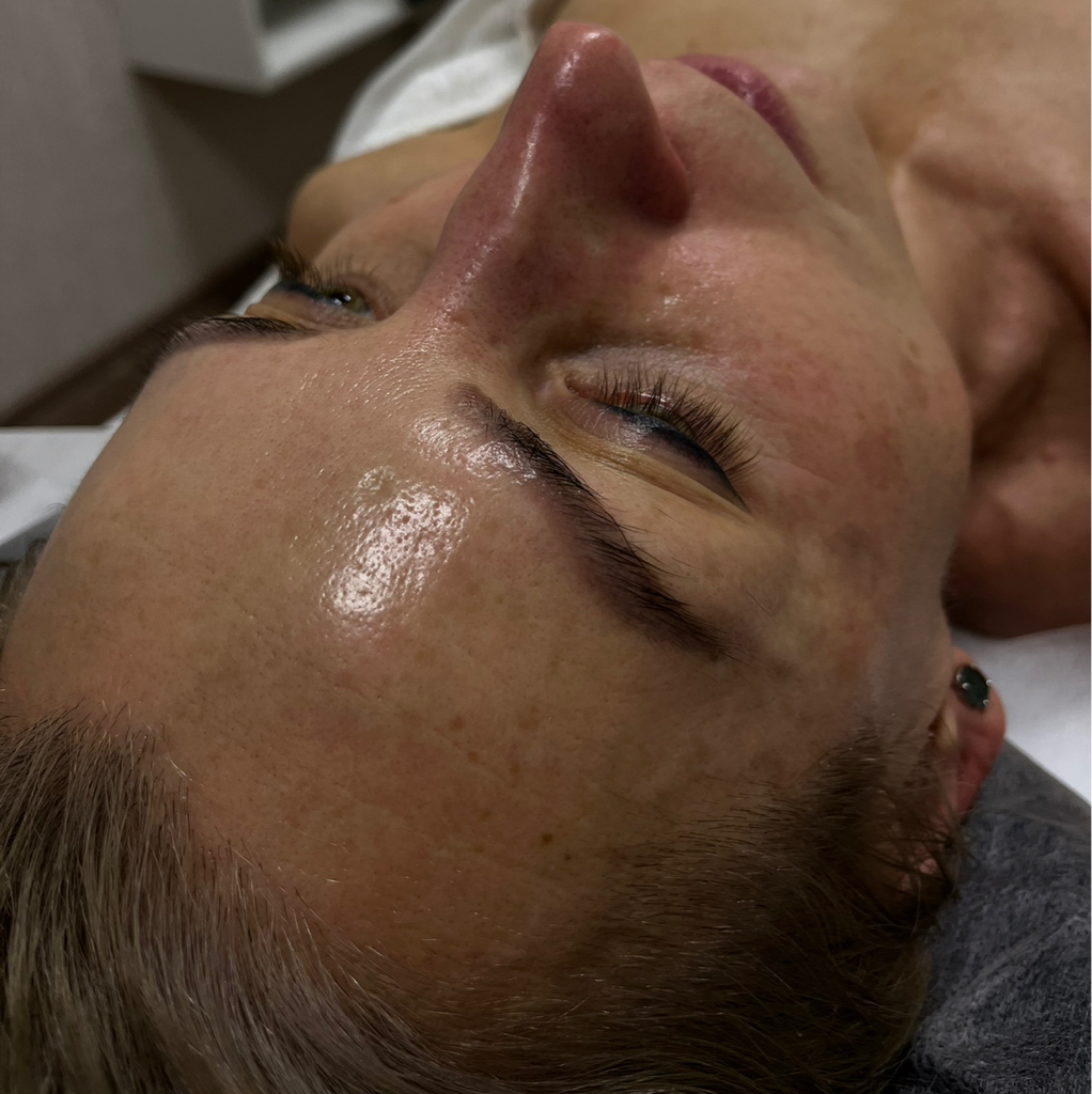 МАССАЖ ЛИЦА+ КАРБОКСИТЕРАПИЯ