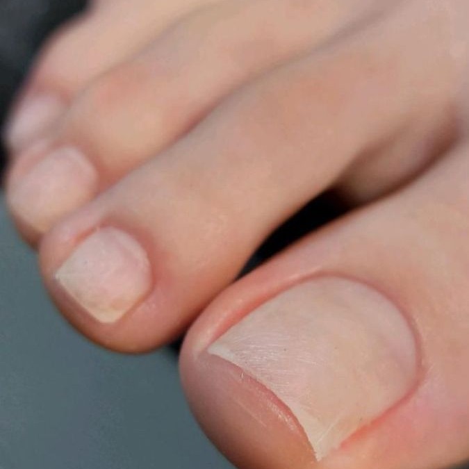 Гигиенический педикюр