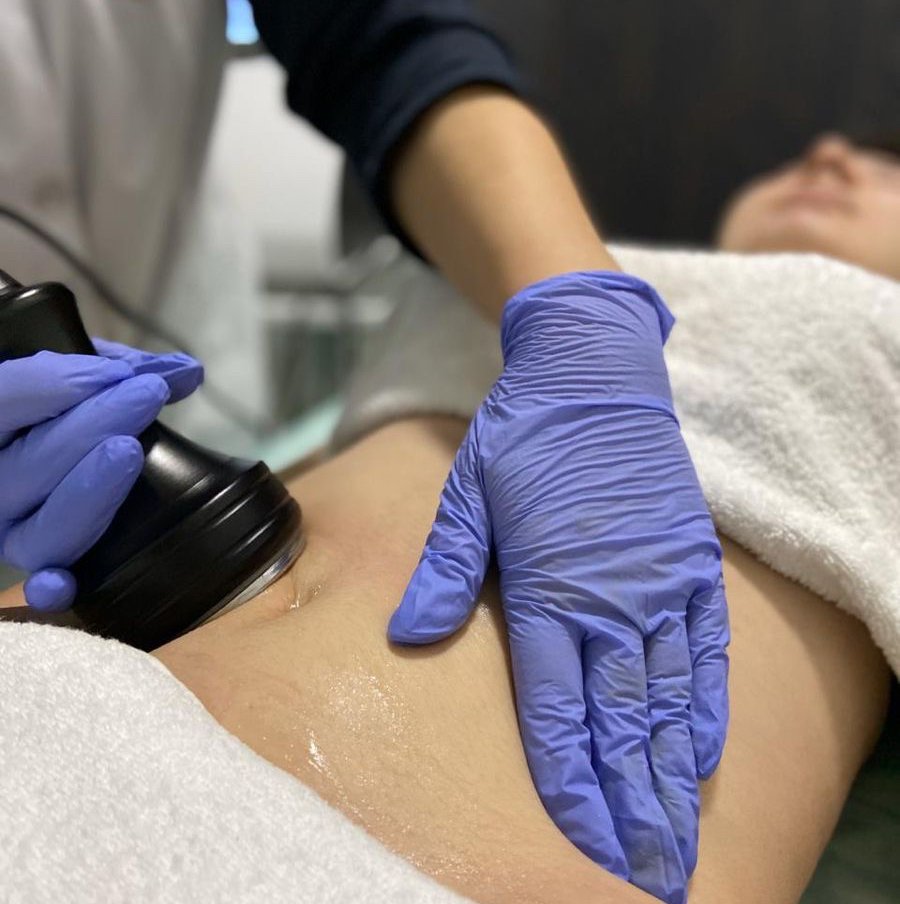 УЗ - кавитация 20 мин