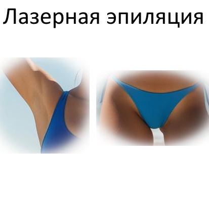 Комплекс S (подмышки + глубокое бикини)