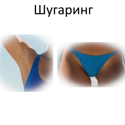 Шугаринг/воск Комплекс S (подмышки + глубокое бикини)