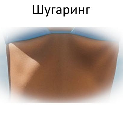 Шугаринг/воск Линия живота