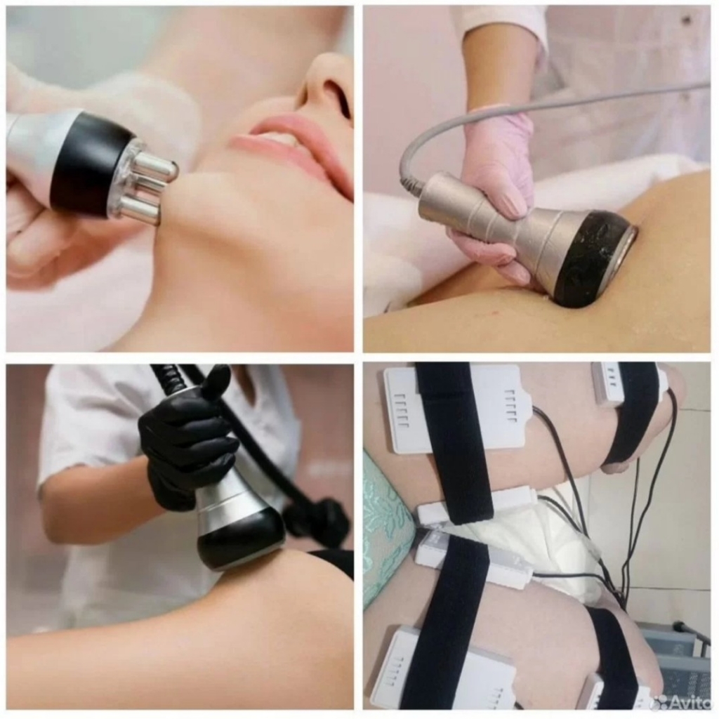Кавитация, вакуум, липолиз, Rf, миостимуляция