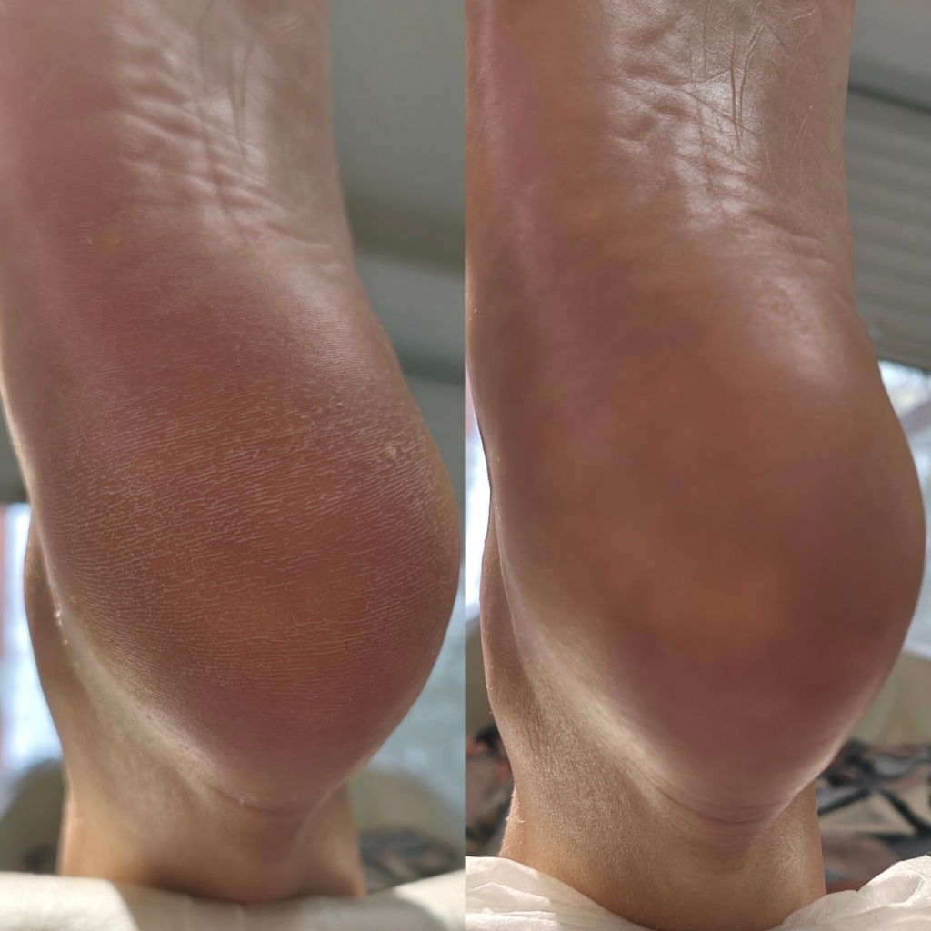 Педикюр стопа + пальчики