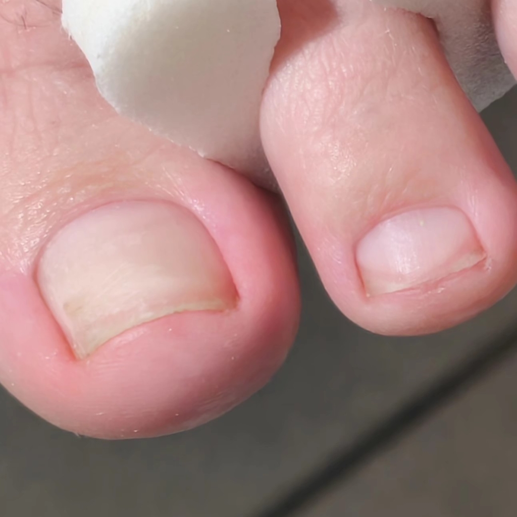 Педикюр пальчики