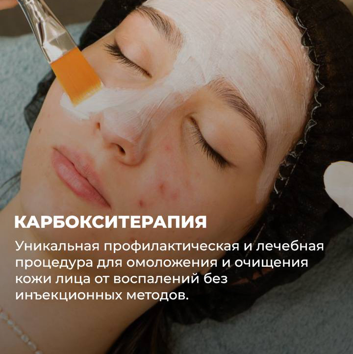 Карбокситерапия