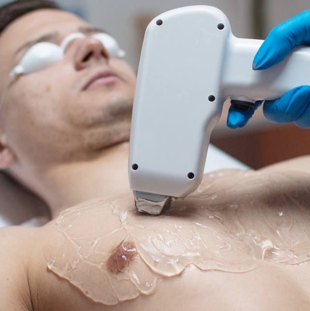 Лазер мужчина - спина