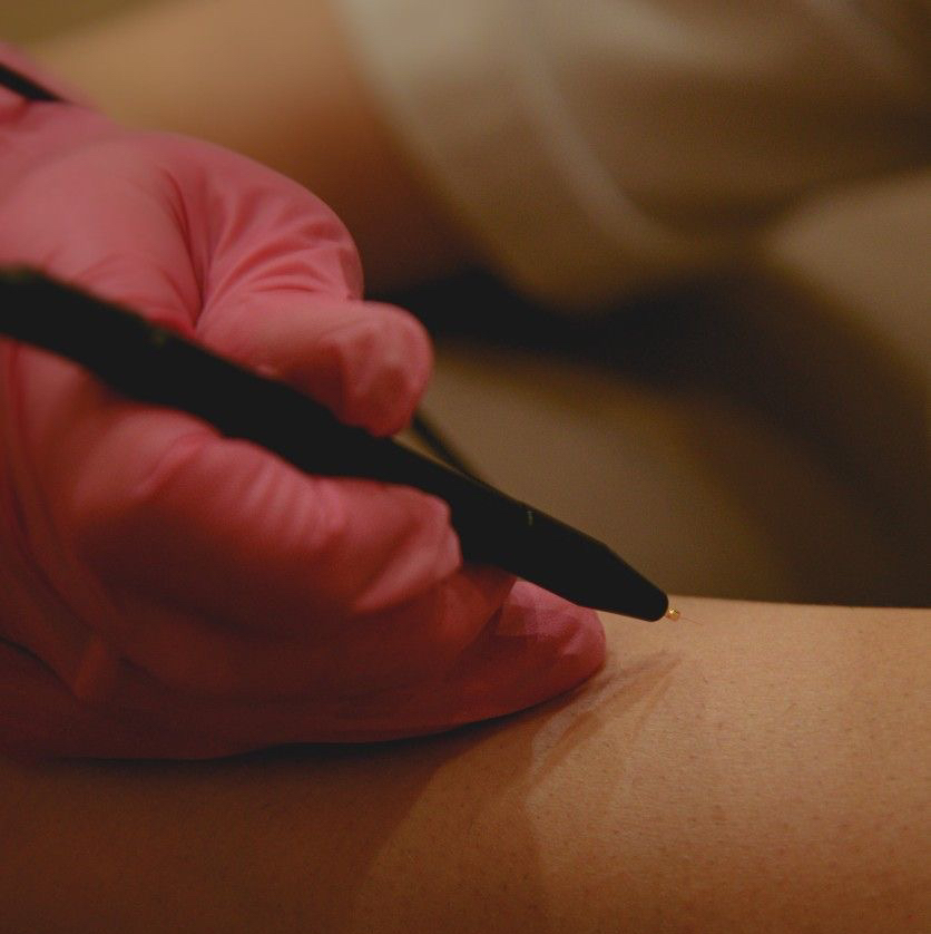 Электроэпиляция 1 час