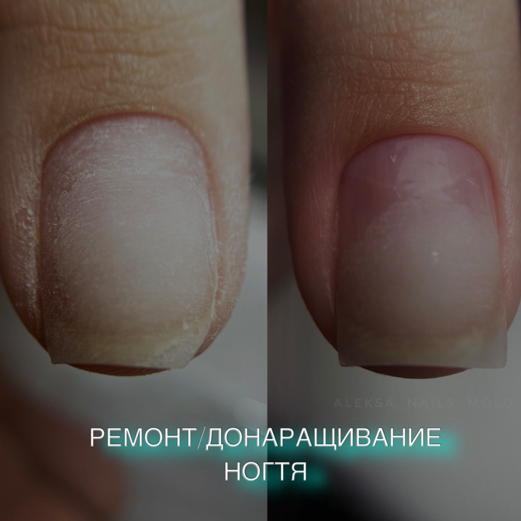 Донаращивание/ремонт ногтей