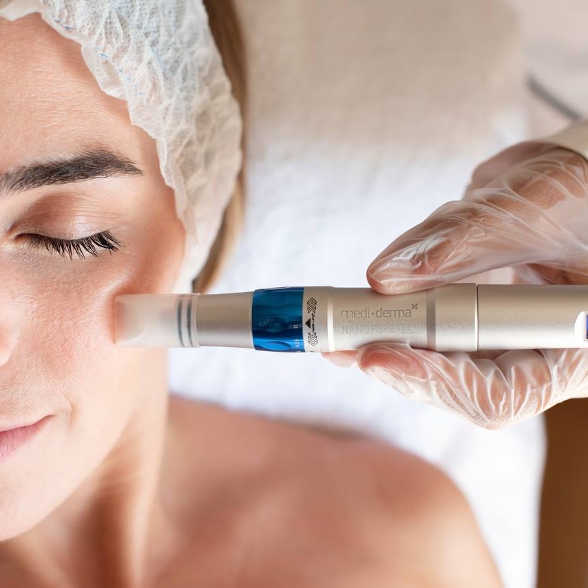 Микронидлинг Nanopore