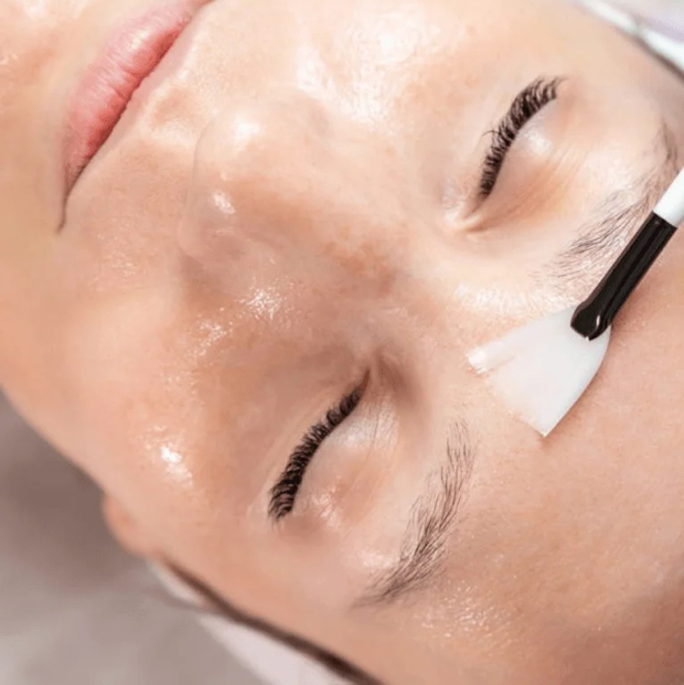 Гликолевый пилинг