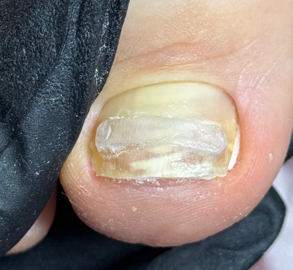 Установка LS-системы