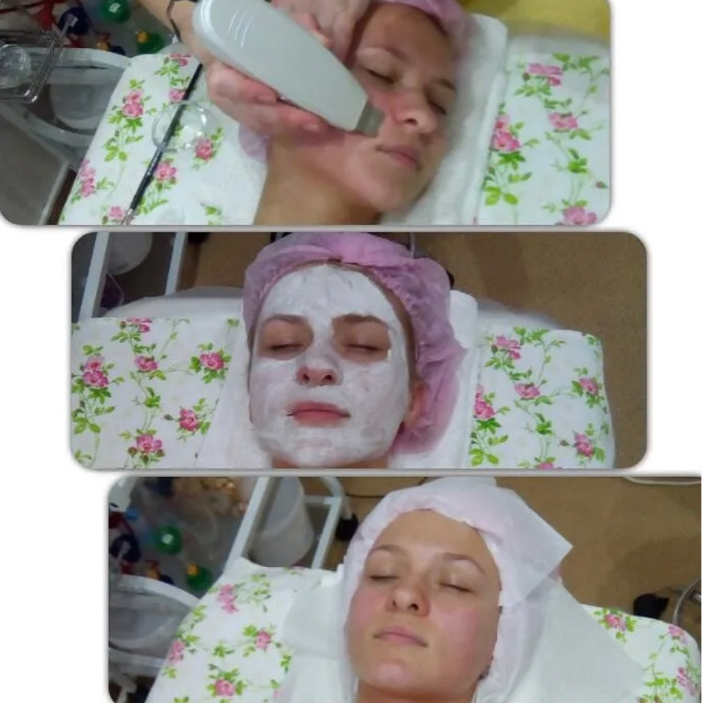 Ультразвуковая чистка кожи лица
