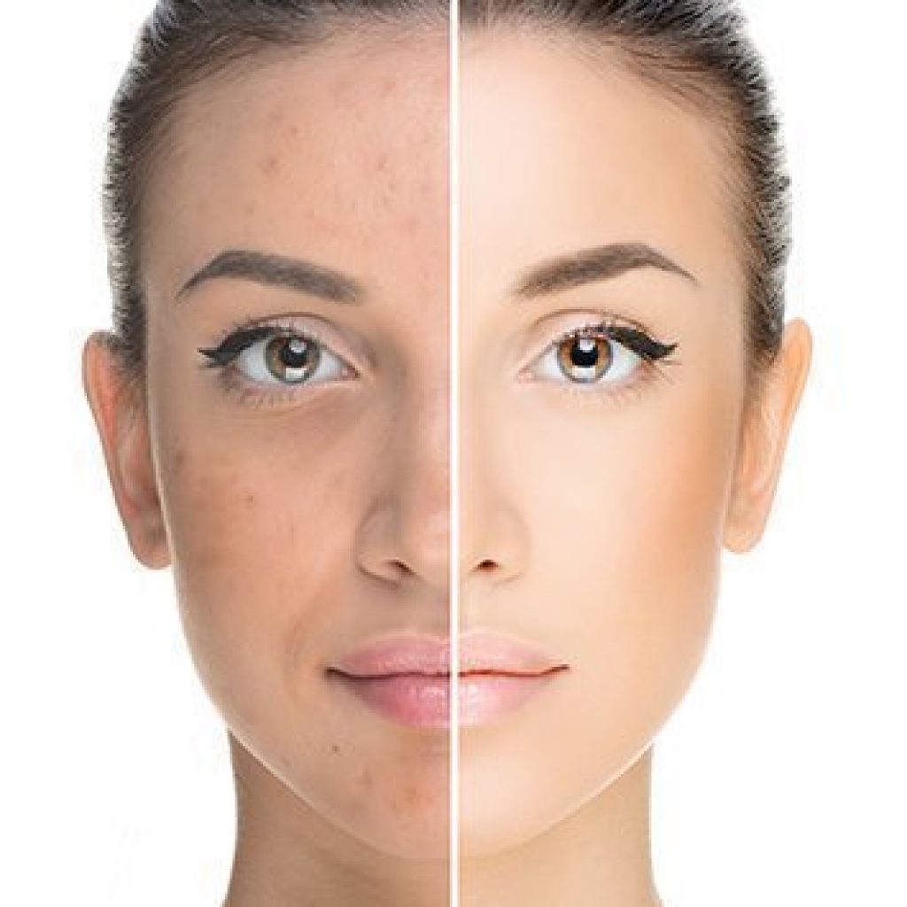 Лечебный осветляющий массаж ZQ-ll