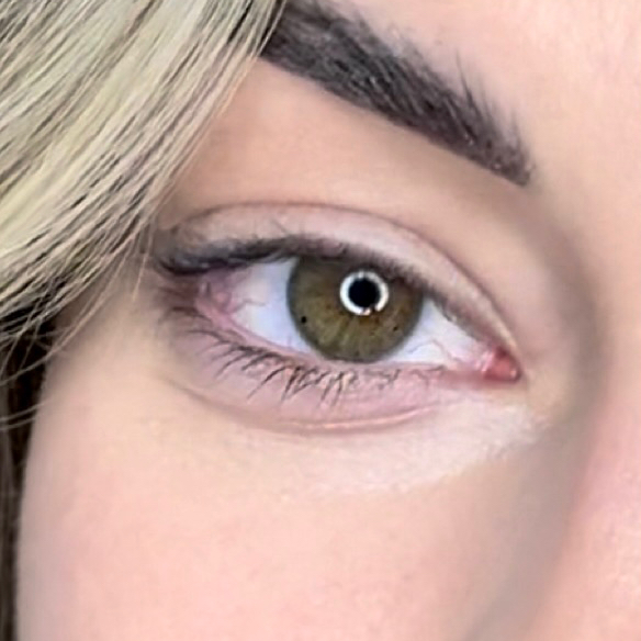 Снятие без наращивания