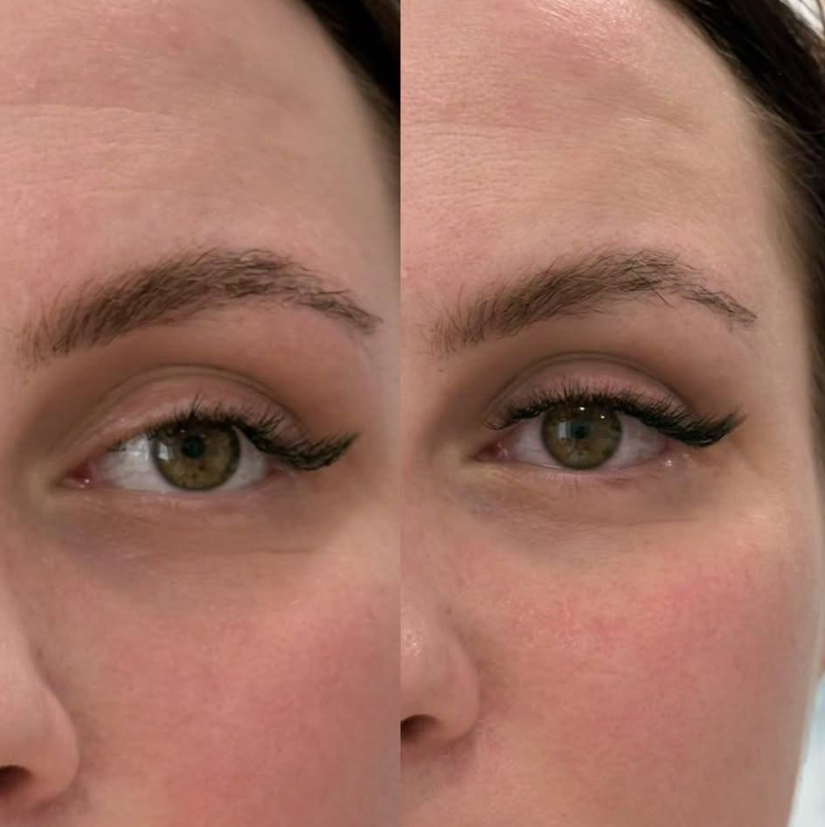 Коррекция ресниц