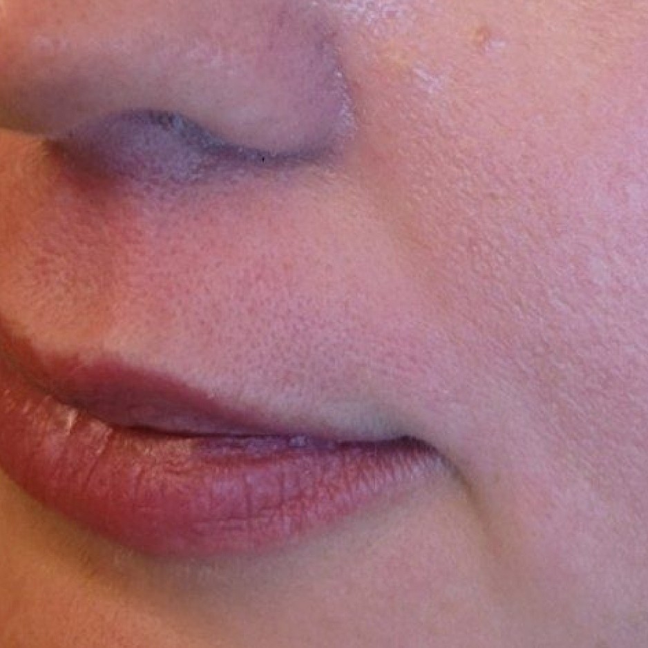 Восковая депиляция лица