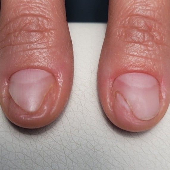 Зачистка ногтевой пластины