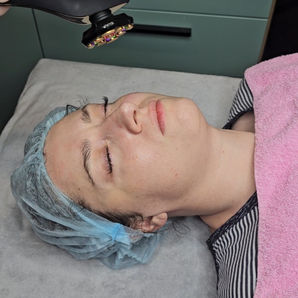 Rf- лифтинг лица и шеи Zeus