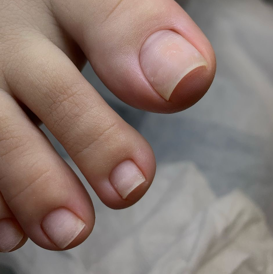 Педикюр гигиенический