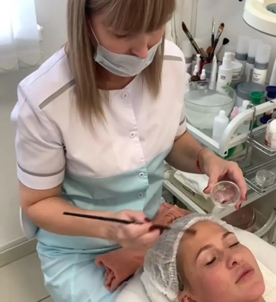 Химические пилинги