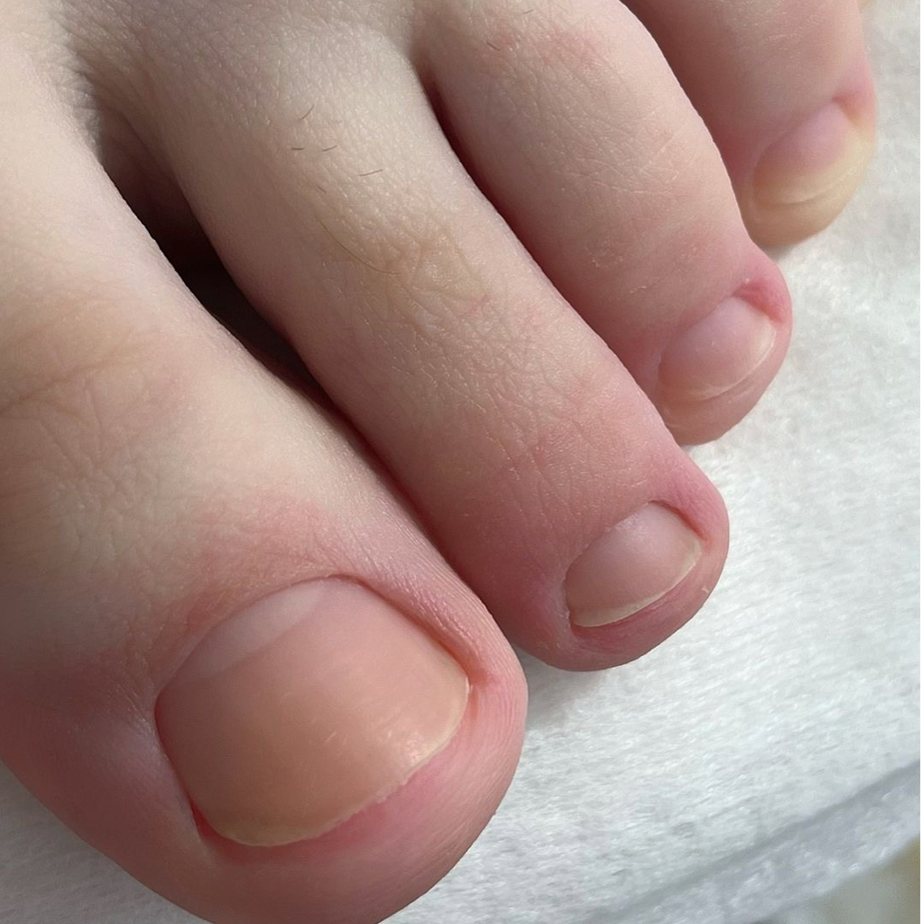 экспресс педикюр (только пальчики)