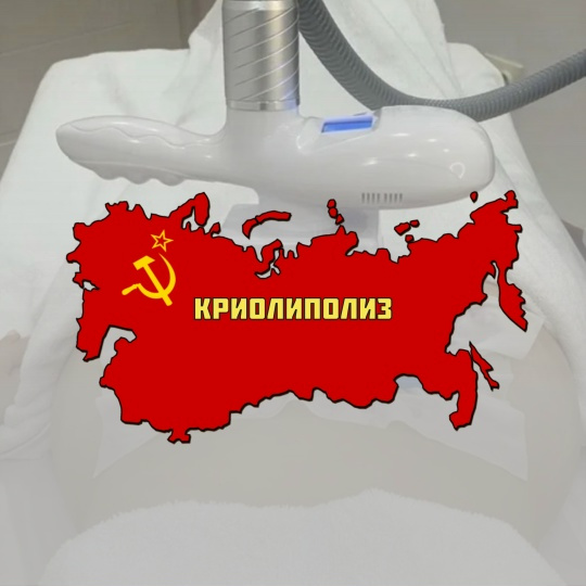 Криолиполиз