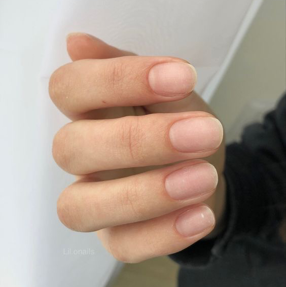 Укрепление IBX