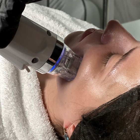 Микроигольчатый RF лифтинг (Шея)