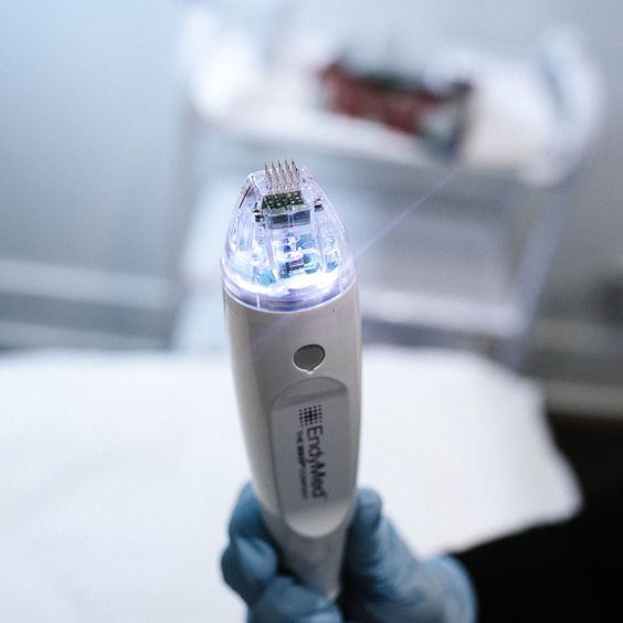 Микроигольчатый RF лифтинг (Декольте)