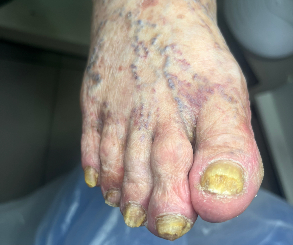 Препаратно-аппаратный педикюр 3 категории