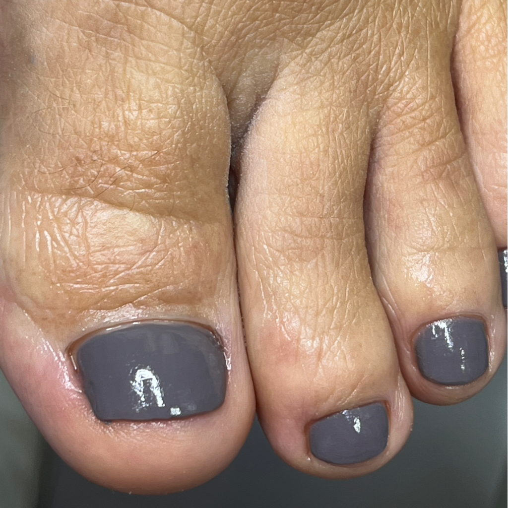 Зачистка и протезирование ногтя